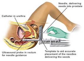 Images from http://www.oncolink.org